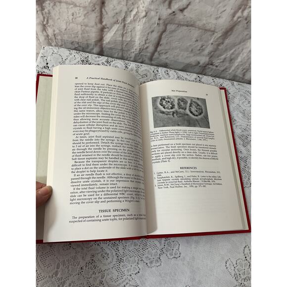 1984 A Practical Handbook of Joint Fluid Analysis by Robert A. Gatter Hardback - Picture 5 of 6